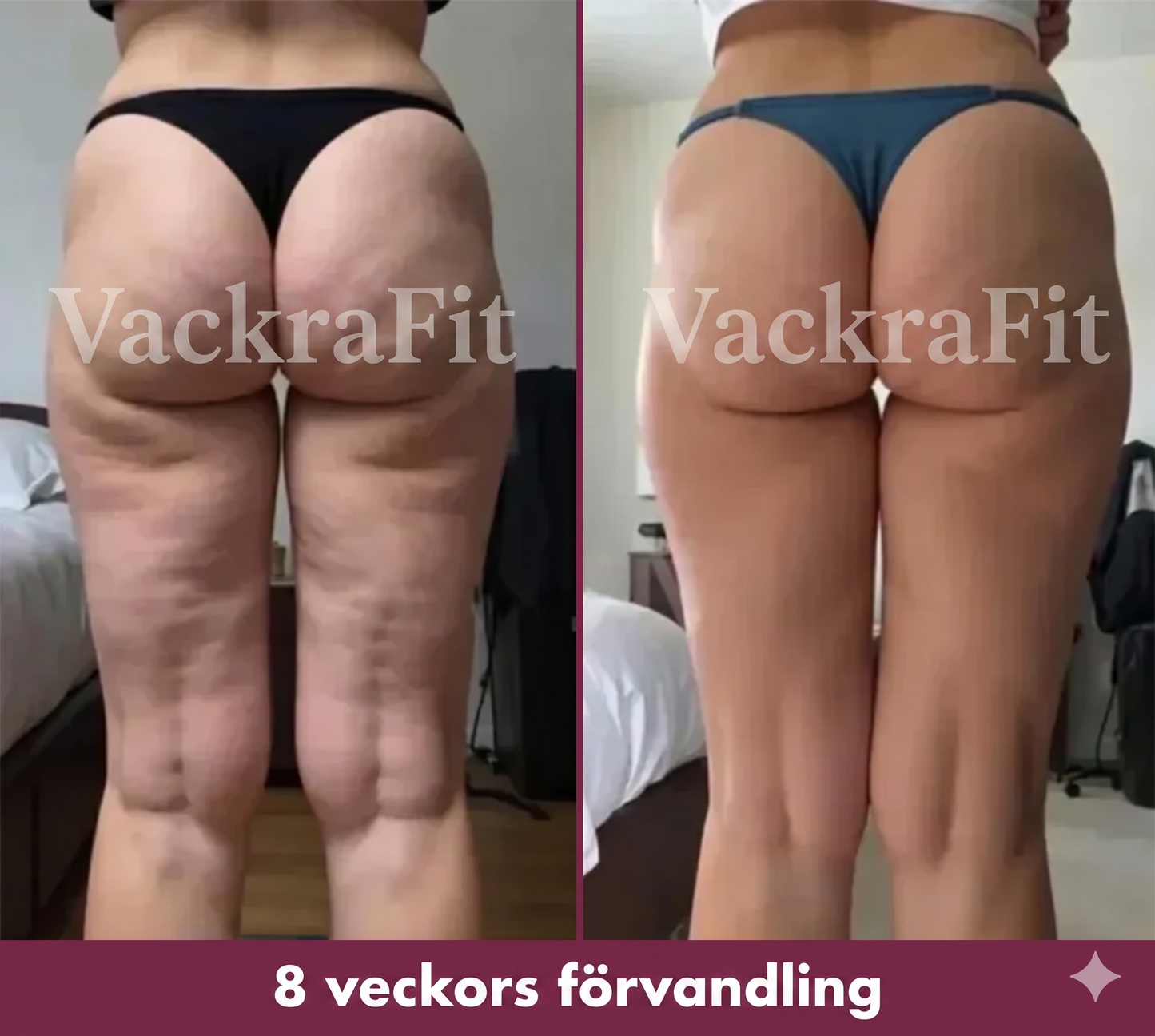 Calmira® Manchon Minceur & Raffermissant Bras